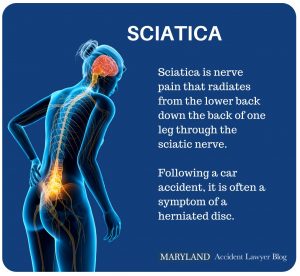 sciatica car accident